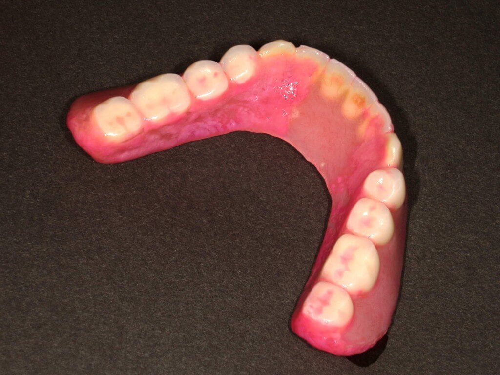 コンフォート入れ歯クリニック-入れ歯